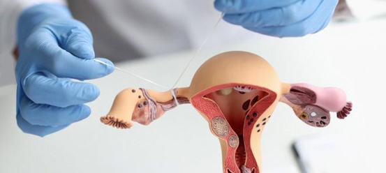 Tüp Bağlatma Ameliyatı (Kordon Bağlatma)